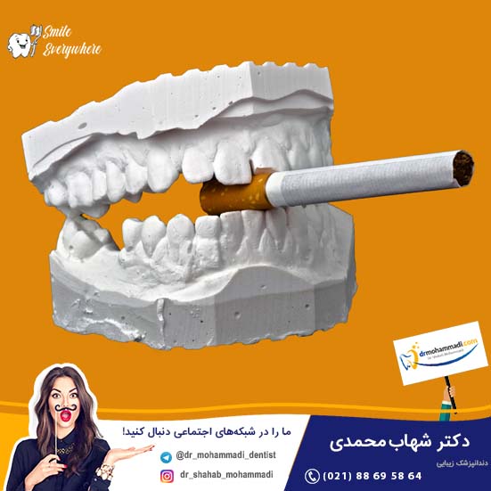 چه افرادی نمی توانند ایمپلنت دندان انجام دهند؟ - کلینیک دندانپزشکی دکتر شهاب محمدی